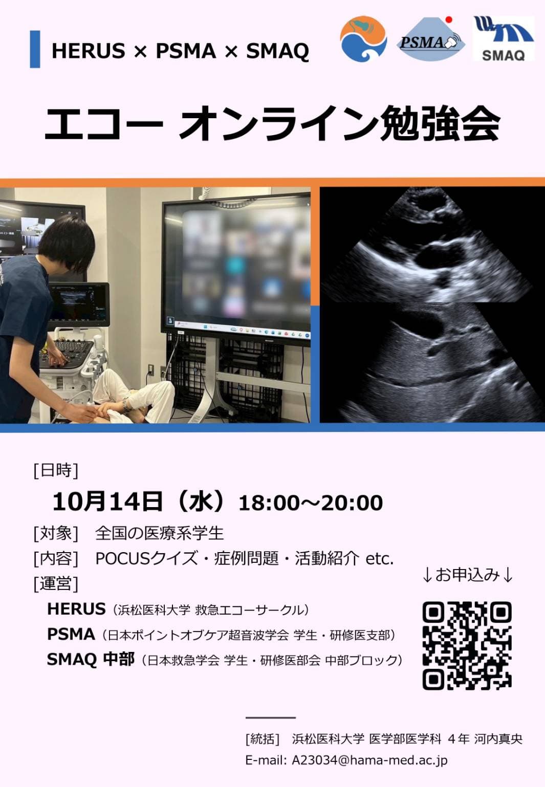 エコーオンライン勉強会